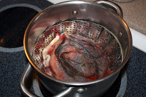 A human placenta and umbilical cord ares teamed prior to dehydration. The placenta is dehydrated and ground to a powder which is then put into a pill capsule for a new mother to consume, hoping to increase their milk production or reduce the postpartum depression. (Photo: Raphaelle Picard/AFP/Getty Images)
